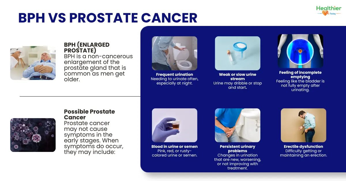 Is It an Enlarged Prostate or Prostate Cancer